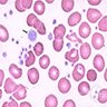 Thrombocytosis seen in CML
