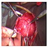 Intraoperative images