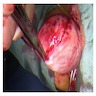 Intraoperative images